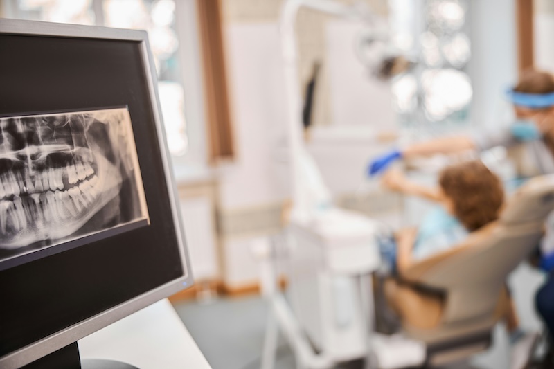 importance of routine dental X-rays